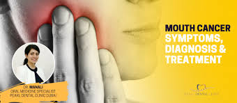Throat cancer that has spread to distant parts of the body is called metastatic throat cancer, which is most often found in the lungs, bones and/or distant biopsy: Throat Cancer Archives Most Recommended Dental Clinic In Dubai