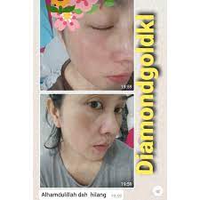 See more of diamond gold skincare original on facebook. Diamond Gold Skincare Original
