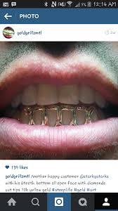 Pin On Gold Grillz