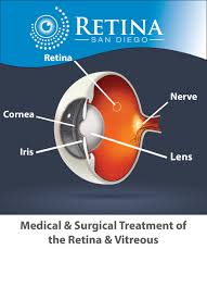 Image result for Retinal Anatomy