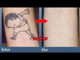 Trying to remove your tattoo at home may seem like a good option, but achieving that professional removal quality can be extremely difficult to do by yourself. Remove Tattoo At Home Very Easy 2020 Temprery Tattoo Remove At Home Tattoo Life Hacks Tattoo Youtube