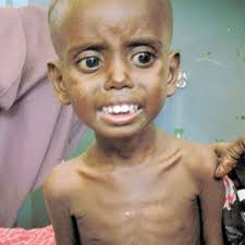 Famine is a wake-up call that we cannot ignore