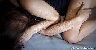 Selbstverletzung Ursachen Symptome Und Therapie Netdoktor