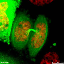 What type of cells undergoes meiosis. Mitosis In 2d Hela Cell Undergoes Mitosis Youtube