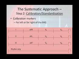12 Lead Interpretation Part 2 The 6 Step 12 Lead Interpretation Process Youtube