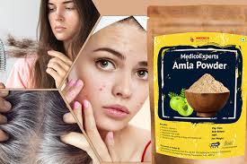 The hesh amla powder is an excellent hair care product that is also suitable for moisturizing and cleansing skin. Are You Concerned About Your Hair Fall Problems Empower Your Health Knowledge With The Benefits Of Amla Powder Medicoexperts