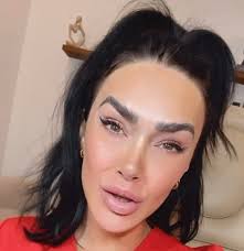 Fillers are out of control : r/UtahInfluencerDrama