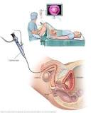 Image result for blood in urine. what is the course