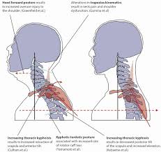 One cubic inch of bone can withstand the weight of five standard pickup trucks, give or take a few pounds. Correcting Forward Head Posture Causes Ways To Help