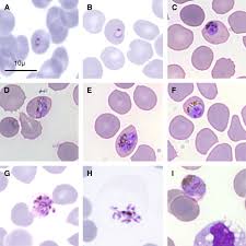 Five species of plasmodium are believed to cause malaria in humans: The Parasite And Its Vectors Scientists Against Malaria