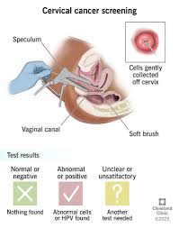 Image result for Screening Test