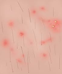 We did not find results for: What Causes Red Spots On Skin Guide To Treatment Types