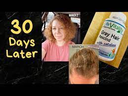 Once we know the benefits of biotin for hair loss and to boost growth, it also becomes easy to deduce that lacking this fundamental vitamin will have consequences for our hair, which will become finer, more fragile and brittle, dull and lifeless. Gray Hair Rescind Supplements 30 Day Update Plus Biotin For Hair Growth Youtube