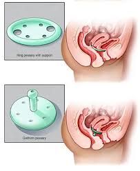 Image result for Pelvic Floor Dysfunction