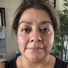 Interpersonal therapy near Albany, CA