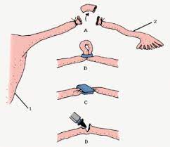 Pin On Health