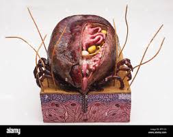 Image result for Tick Paralysis