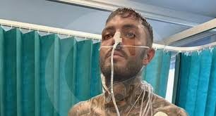 Hombre no fue al médico a tiempo y fue diagnosticado con cáncer terminal