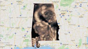 Aclu Planned Parenthood Bring Lawsuit Against Alabama Abortion Law