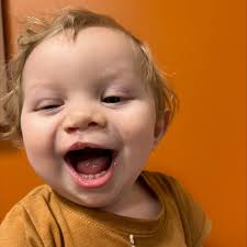 UMMC Pediatric Plastic Surgery