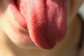 Penampilan maupun ukuran bintik putih di bibir bisa beragam. Macam Macam Sakit Dilihat Dari Lidah Lidah Bewarna Putih Apa Artinya Antara News