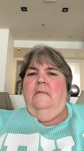 2025 Superbowl commentary #chiefs #eagles #gocowboys