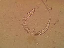 Image result for Strongyloides