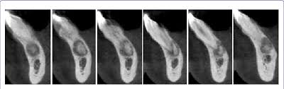 275 фраз в 45 тематиках. Note The Intimate Relationship Of The Lesion With The 1 3 Apical Part Download Scientific Diagram