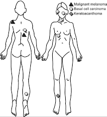 It's characterized most commonly by the appearance of dry, thickened skin patches. The Risk Of Skin Cancer In Psoriasis Patients Treated With Uvb Therapy Html Acta Dermato Venereologica