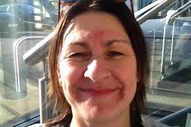 Beautiful' woman, 20, 'gives up' fight against cancer and refuses chemo  after her mum's freak death in front of her at Heathrow Airport