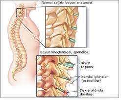 boyun kireclenmesi boyun fitigi tedavisi saglik anne olmak bel fitigi