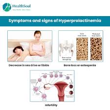 Image result for Hyperprolactinemia