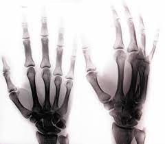 Photo, sketch and paint effects. Inverted Hand Xray Photo Editing X Ray Hands