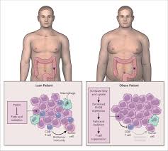 Image result for Obesity