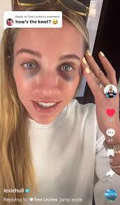 They just wheeled her out