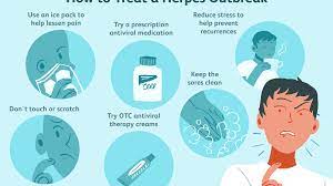 Hsv1 stands for herpes simplex virus type 1. Effective Treatments For Herpes