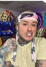 Hank and Henry Hair Surgery