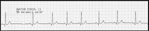 However, age as well as level of fitness can increase or lower resting. Electrocardiography Diagnosis And Management Of Common Arrhythmias Wsava2013 Vin