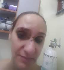 Four Individuals to Appear in Court for Savage Beating of Guyanese  Businesswoman