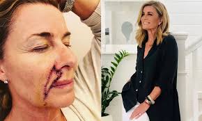 Deborah Hutton, 58, reveals she has undergone cancer surgery