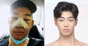 Korea's first and only plastic surgery clinic designated as a good medical institution to attract foreign patients by the korean government. More South Korean Men Are Having Plastic Surgery To Look Pretty Like K Drama Actors