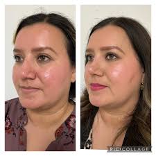 Otorrino en Hermosillo