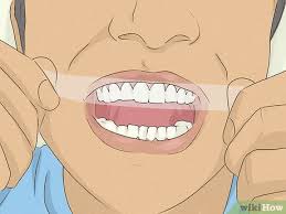 Effective aligners · have your smile assessed · indivudual treatment 4 Ways To Get Whiter Teeth At Home Wikihow