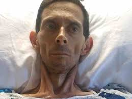 Fundraiser for Anayolanda Gamboa by Michie Santiago : Giovanni's Cancer  Battle