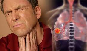 Chest and bone pain one of the symptoms of lung cancer may be pain in the chest, shoulder, or back area. Lung Cancer Symptoms Signs The Disease Is Advanced And Has Spread Outside The Lungs Express Co Uk