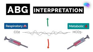 Image result for ABG Interpretation