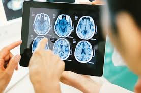 Concussions can cause symptoms similar to adhd, but it is not adhd. Suspect A Concussion How To Help Not Hurt Your Recovery Health Essentials From Cleveland Clinic