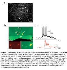 Image result for Eye Rest Green 1972 Hussmann