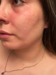 Cecred product usage order?