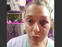 Hastings woman attacked in Alexandra Park